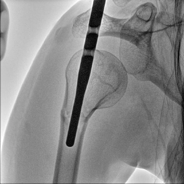 orthopedic image orthopedic image